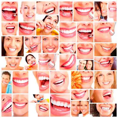 muchas sonrisas esteticas con carillas dentales
