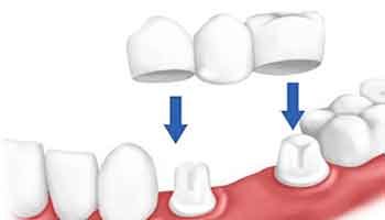 puente-dental_