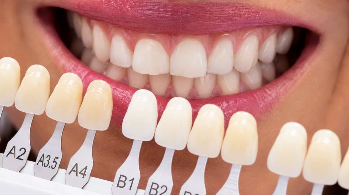 color dental