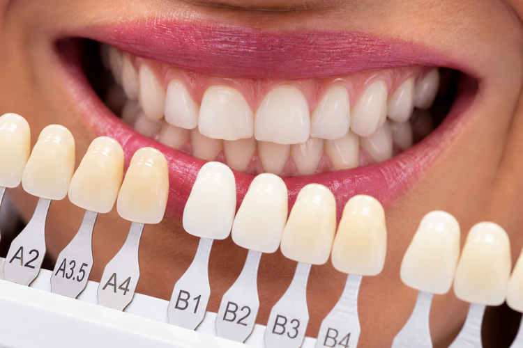 color dental